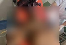 Duel Berdarah Rekan Kerja di Muara Teweh, Satu Korban Luka Parah, Pelaku Kabur