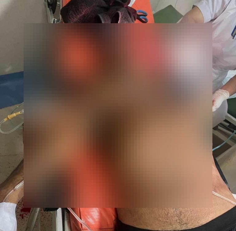 Duel Berdarah Rekan Kerja di Muara Teweh, Satu Korban Luka Parah, Pelaku Kabur